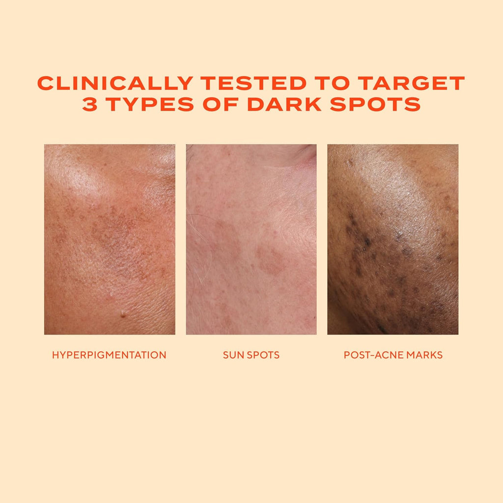 Murad Rapid Dark Spot Correcting Serum - Advanced Anti-Aging Formula with Patented Resorcinol Technology, Tranexamic and Glycolic Acids for Hyperpigmentation, Dark Spots and Dull Skin - 1 Fl Oz