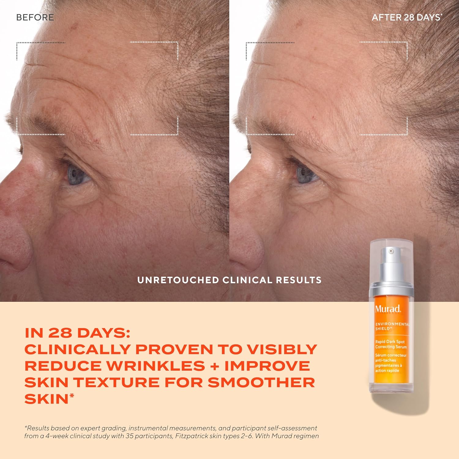 Murad Rapid Dark Spot Correcting Serum - Advanced Anti-Aging Formula with Patented Resorcinol Technology, Tranexamic and Glycolic Acids for Hyperpigmentation, Dark Spots and Dull Skin - 1 Fl Oz